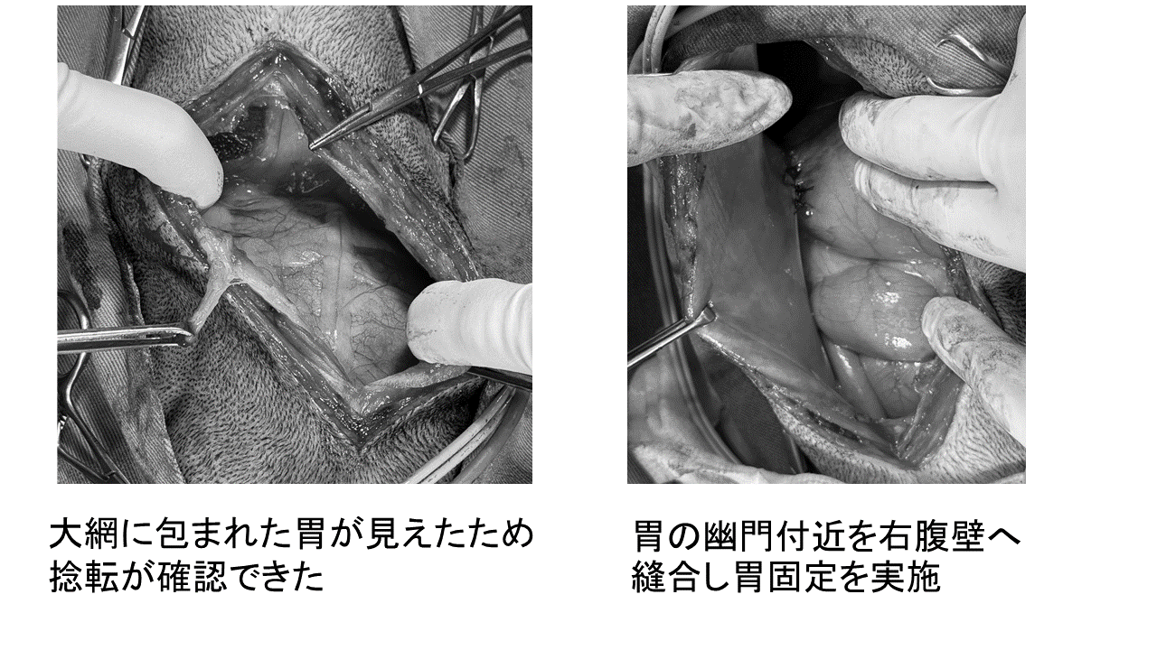症例画像2