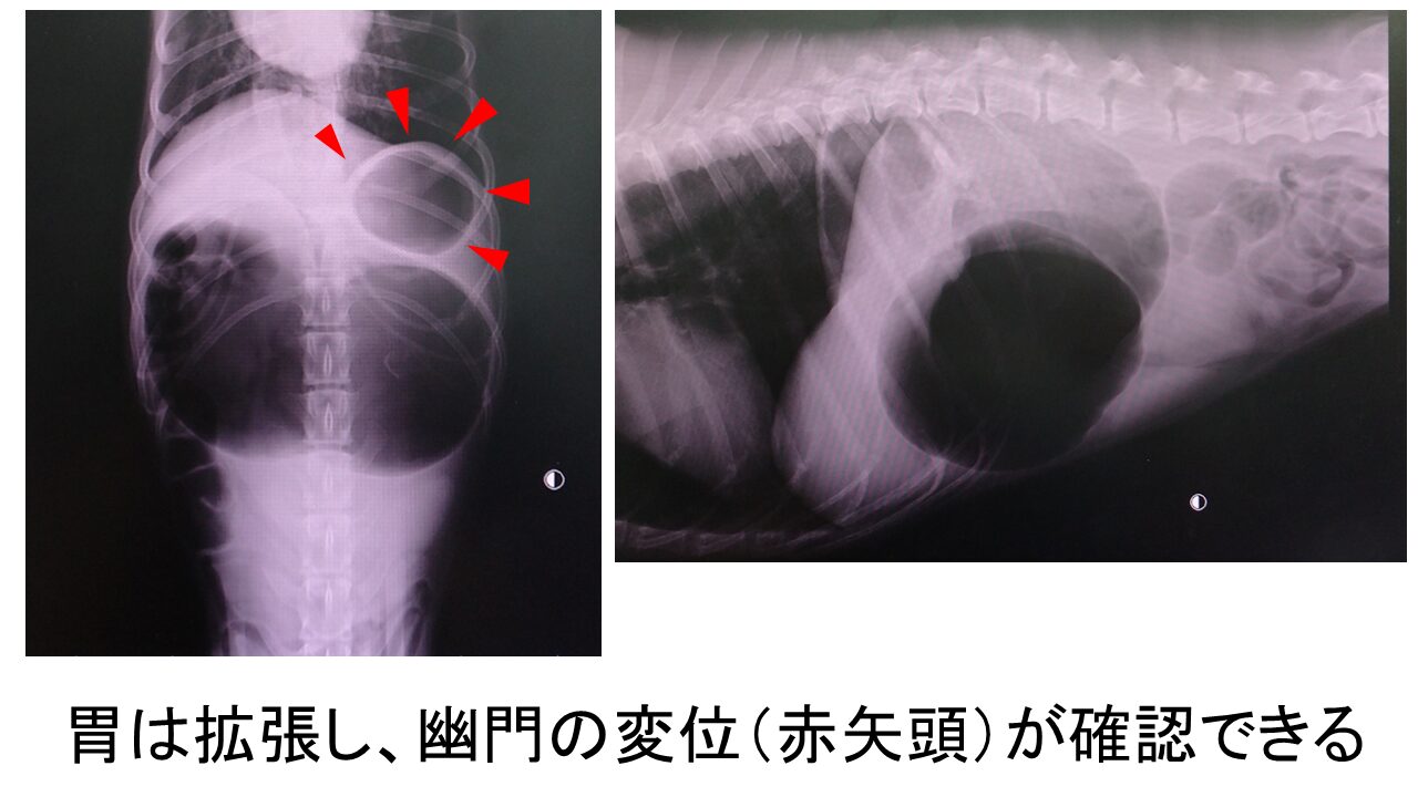 症例画像