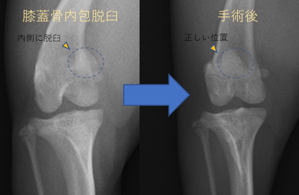 症例画像